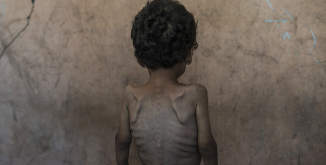 © Jehad Al-Sharafi - Muerte eterna