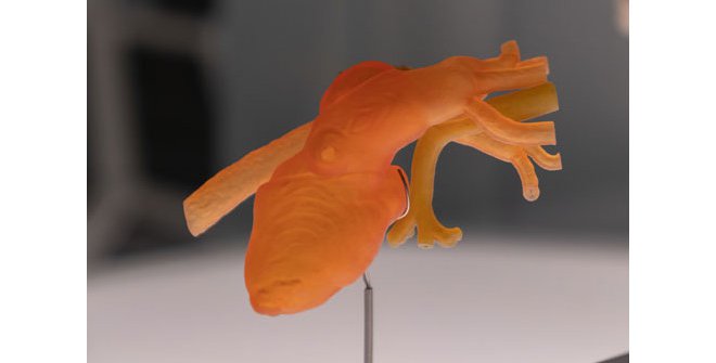 PRINT3D - Impresión 3D y salud